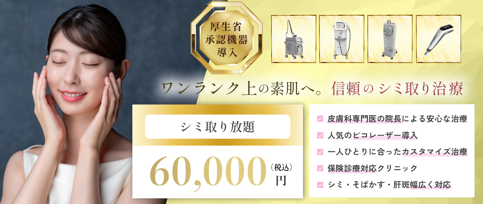 シミ取りキャンペーン