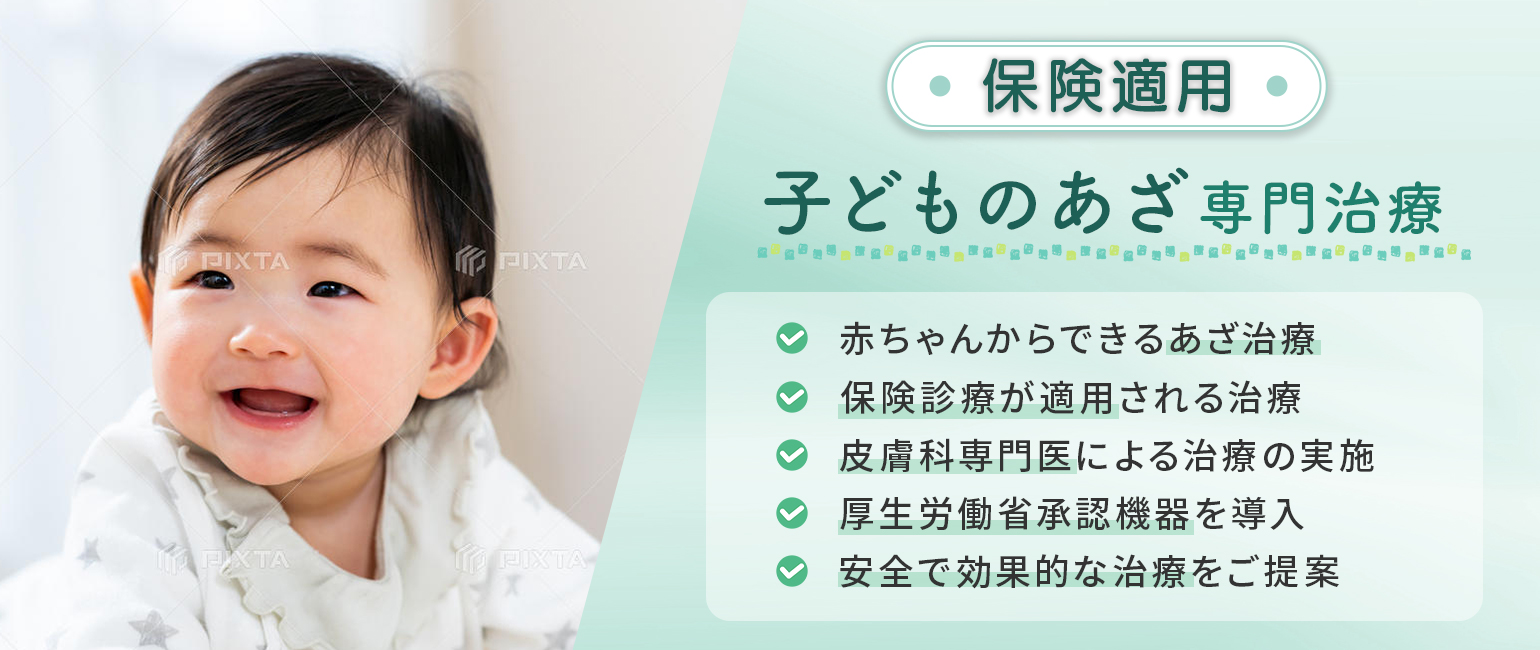 異所蒙古斑バナー